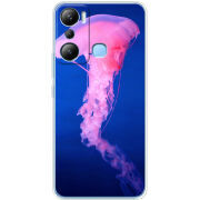 Чехол BoxFace Infinix Hot 20i 
