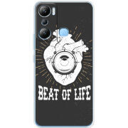 Чехол BoxFace Infinix Hot 20i 