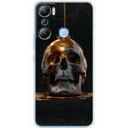 Чехол BoxFace Infinix Hot 20i 