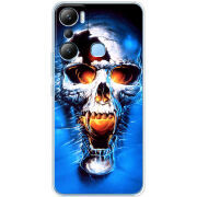 Чехол BoxFace Infinix Hot 20i 