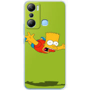 Чехол BoxFace Infinix Hot 20i 