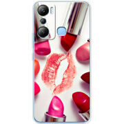 Чехол BoxFace Infinix Hot 20i 