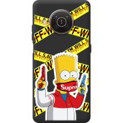 Черный чехол BoxFace Nokia X10 White Bart