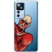 Прозрачный чехол BoxFace Xiaomi 12T / 12T Pro Титан