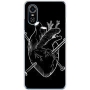 Чехол BoxFace ZTE Blade A31 Plus 