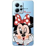 Прозрачный чехол BoxFace Xiaomi Redmi Note 12 4G Lady M