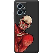 Черный чехол BoxFace Xiaomi Redmi Note 12 4G Титан