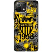 Черный чехол BoxFace Xiaomi 11 Lite 5G NE 
