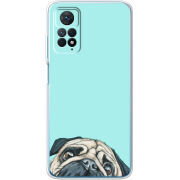 Чехол BoxFace Xiaomi Redmi Note 11E Pro 