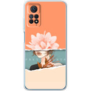 Чехол BoxFace Xiaomi Redmi Note 12 Pro 4G 