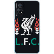 Чехол BoxFace Xiaomi Redmi Note 12 Pro 4G L. F. C.
