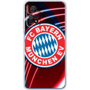 Чехол BoxFace Xiaomi Redmi Note 12 Pro 4G 