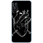 Чехол BoxFace Xiaomi Redmi Note 12 Pro 4G 