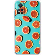 Чехол BoxFace Xiaomi Redmi Note 12 Pro 4G 