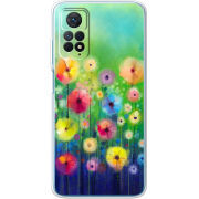 Чехол BoxFace Xiaomi Redmi Note 12 Pro 4G 