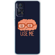 Чехол BoxFace Xiaomi Redmi Note 12 Pro 4G 
