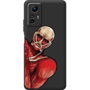 Черный чехол BoxFace Xiaomi Redmi Note 12S Титан