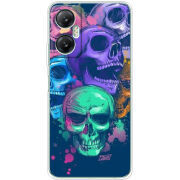 Чехол BoxFace Infinix Hot 20 5G 