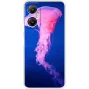 Чехол BoxFace Infinix Hot 20 5G 