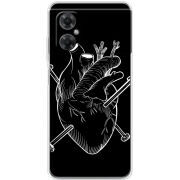Чехол BoxFace Xiaomi Redmi Note 11R 