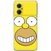 Чехол BoxFace Xiaomi Redmi Note 11R 
