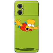 Чехол BoxFace Xiaomi Redmi Note 11R 