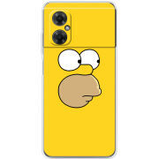 Чехол BoxFace Xiaomi Redmi Note 11R 