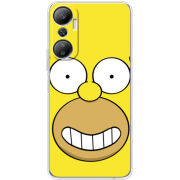 Чехол BoxFace Infinix Hot 20 4G 