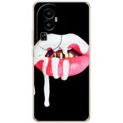 Чехол BoxFace OPPO Reno 10 (China) 