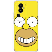 Чехол BoxFace OPPO Reno 10 (China) 