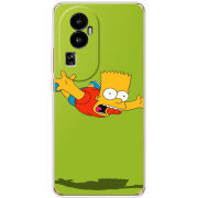 Чехол BoxFace OPPO Reno 10 (China) 