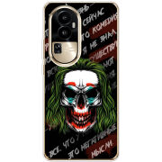 Чехол BoxFace OPPO Reno 10 Pro (China) 