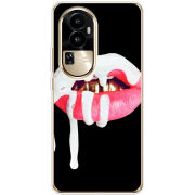 Чехол BoxFace OPPO Reno 10 Pro (China) 