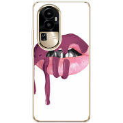 Чехол BoxFace OPPO Reno 10 Pro (China) 