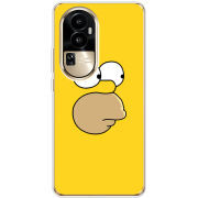 Чехол BoxFace OPPO Reno 10 Pro (China) 