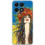 Чехол BoxFace Honor X8a Ukraine Girl