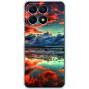 Чехол BoxFace Honor X8a 