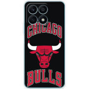 Чехол BoxFace Honor X8a 