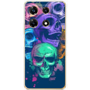 Чехол BoxFace Infinix Note 30 Pro 4G 