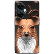 Чехол BoxFace OnePlus Nord CE 3 Lite 