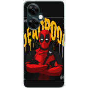 Чехол BoxFace OnePlus Nord CE 3 Lite 