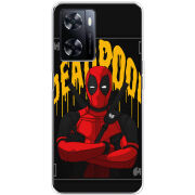 Чехол BoxFace OnePlus Nord N20 SE 