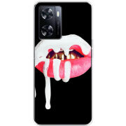 Чехол BoxFace OnePlus Nord N20 SE 