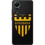 Черный чехол BoxFace OPPO A78 4G 