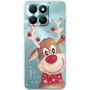 Прозрачный чехол BoxFace Honor X6a Winter Deer