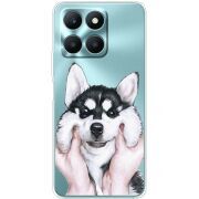 Прозрачный чехол BoxFace Honor X6a Husky