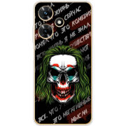 Чехол BoxFace Infinix Hot 30i 