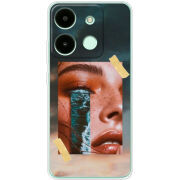 Чехол BoxFace Infinix Smart 7 HD 