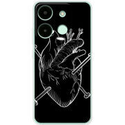 Чехол BoxFace Infinix Smart 7 HD 