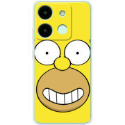 Чехол BoxFace Infinix Smart 7 HD 